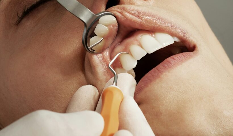 Dental care and oral hygiene