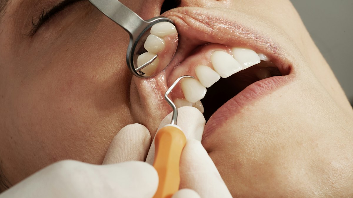 Oral Health Guide: Prevent Cavities, Gum Disease and Tooth Sensitivity